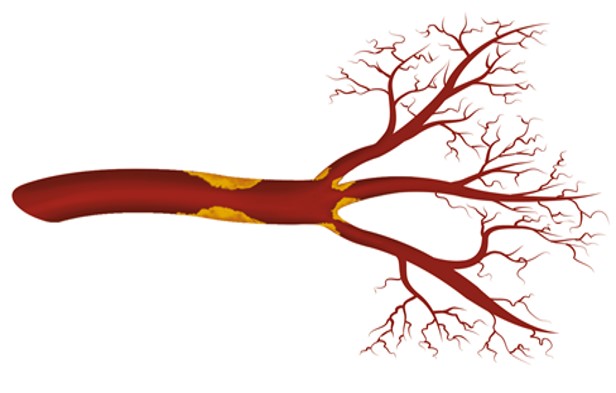 2020-ClinicalProblem4